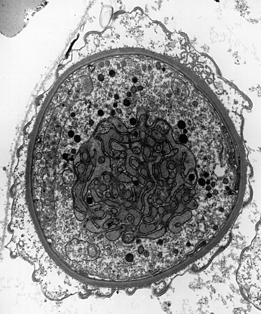 Single-Celled Parasite - Ian Kaplin, University of Sydney